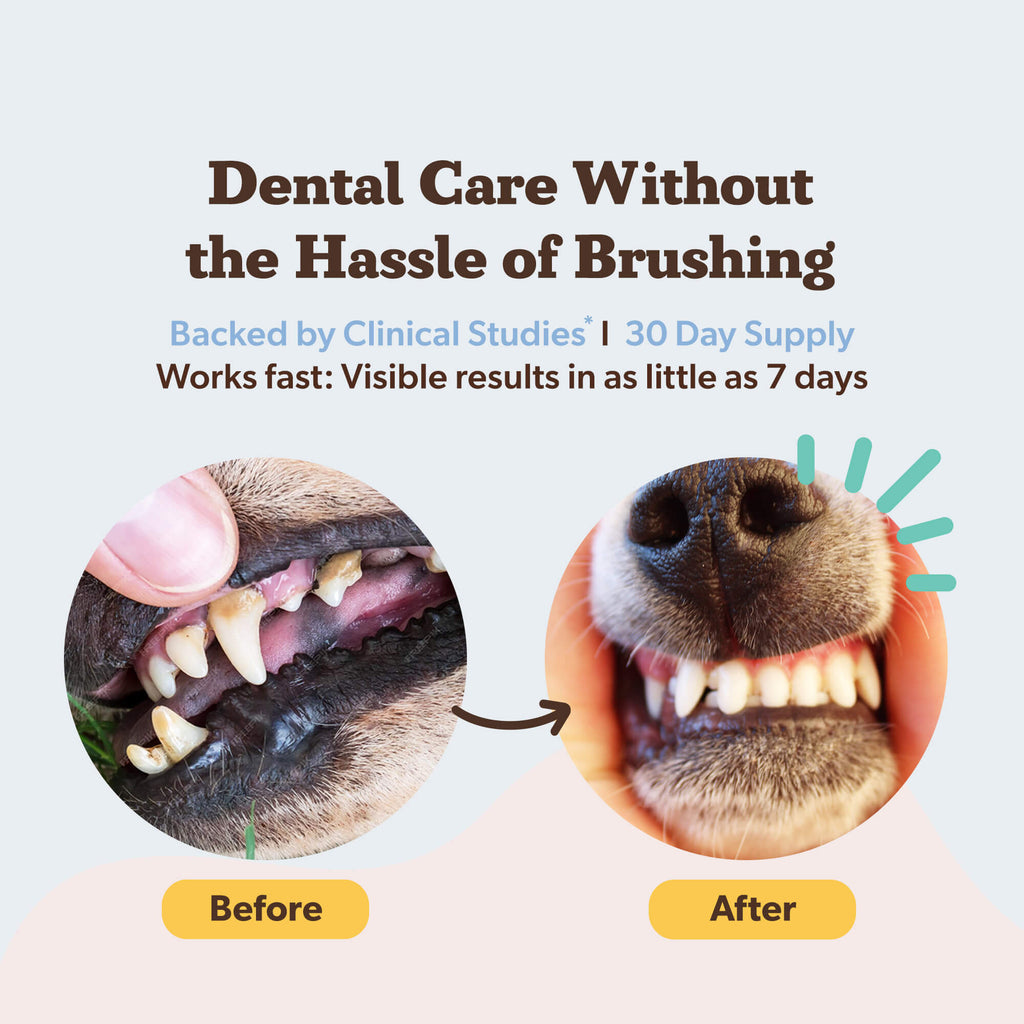 Dental Powder