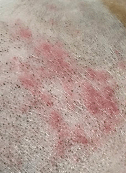 Dog rash